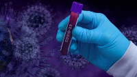 В России официально зафиксировали случай повторного заражения коронавирусом