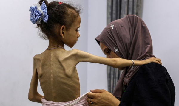 ООН впервые объявила состояние катастрофического голода в Газе