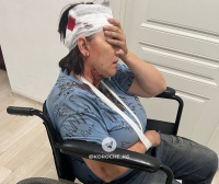 В центре Бишкека самокатчик сбил женщину и скрылся, она попала в реанимацию