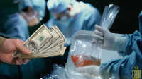 Незаконная трансплантация органов в Кыргызстане – кто в зоне риска?