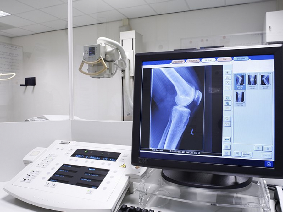 В ОЦСМ № 3 Бишкека появился новый цифровой рентген-аппарат. Кто может пройти обследование бесплатно?