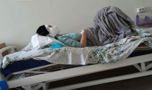 Мужчина отрезал нос и уши бывшей жене. Открыт сбор средств пострадавшей