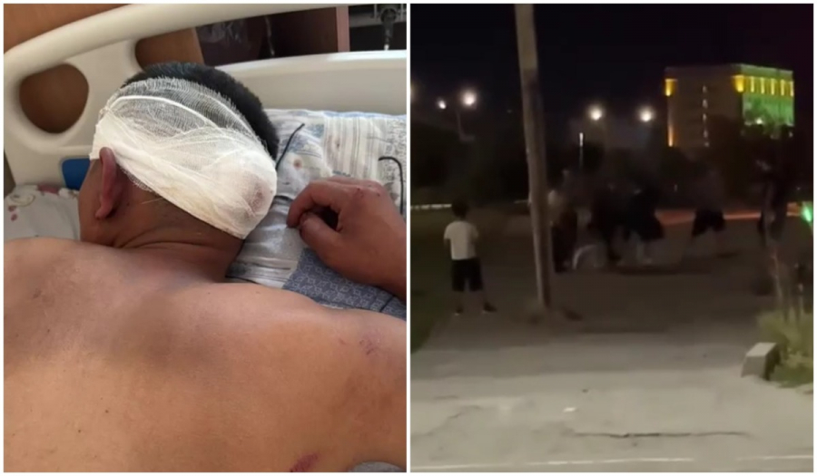 Толпа молодых людей жестоко избила мужчину в Бишкеке, виновных отпустили (видео)