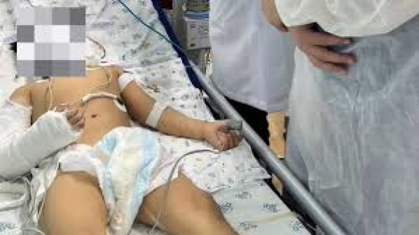 4-летняя девочка выпавшая с 6-этажа в Джале переведена из реанимации в отделение нейротравмы