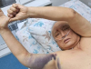 Султанбай Айжигитов получил травмы и находится в больнице (фото)
