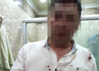 Вице-мэр Бишкека и сотрудник ГКНБ жестоко избили мужчину? Представители муниципалитета выезжают разбираться