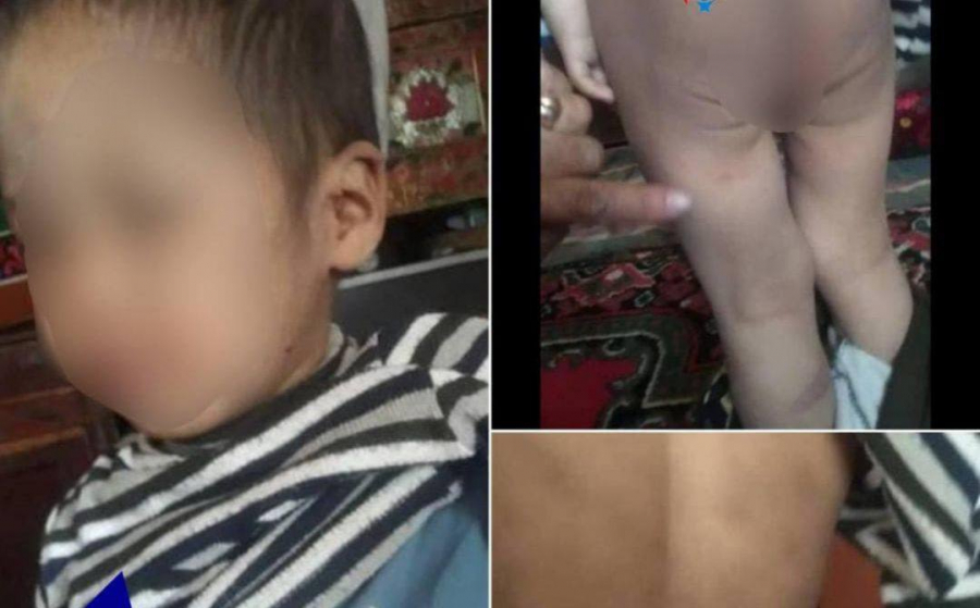 В Ошской области трехлетнего мальчика избила родственница