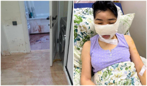 Изувеченную бывшим мужем Асель отказались принимать в больнице из-за прописки