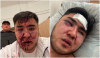 В Бишкеке избили шоумена Рыскелди Нурлан уулу - видео